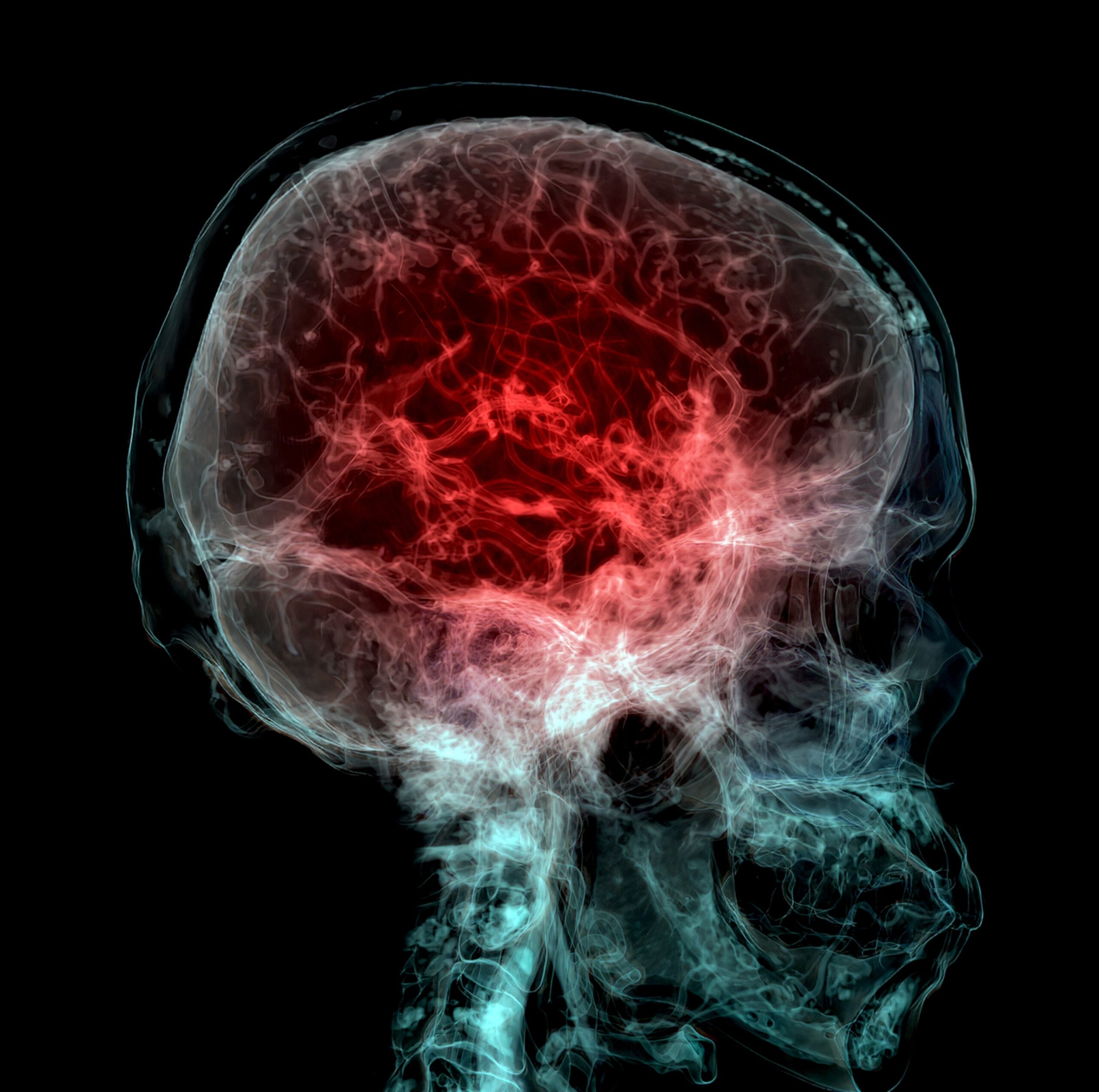 Plastic is entering human blood,Brain, and bone marrow.